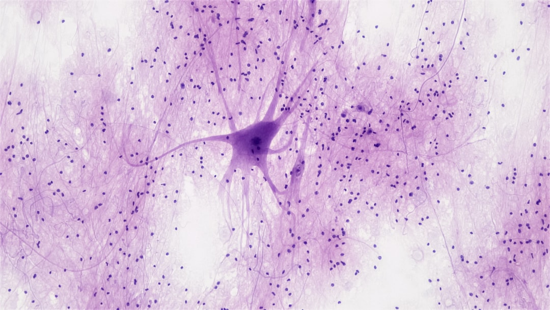 Nervous Tissue: Spinal Cord Motor Neuron